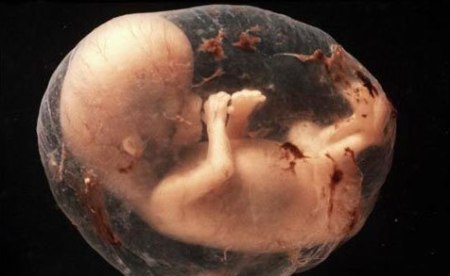ABORTO LA BANALITA DEL MALE